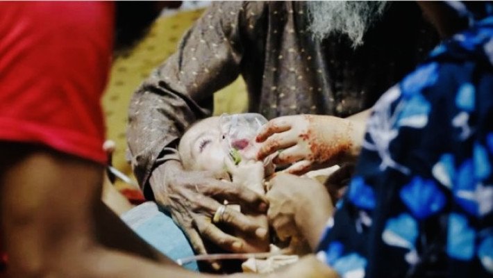 দেশে হামের ভয়াবহ বিস্তার: আক্রান্ত ৬ হাজার ছাড়াল, মৃত্যু ১১৪