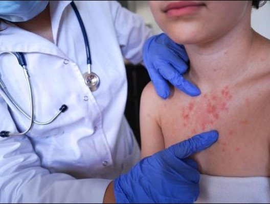 দেশে ২৪ ঘণ্টায় ৫ মৃত্যু, আক্রান্ত ১২৮২ শিশু